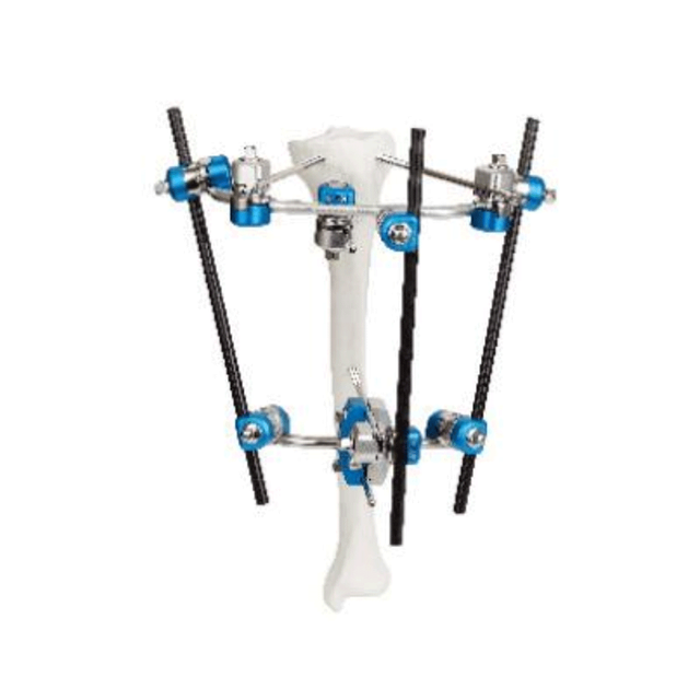 胫骨近端外部固定器II