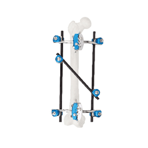 半环 /标准外部固定器