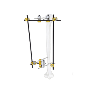 肱骨近端外部固定器