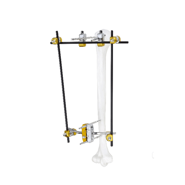 肱骨近端外部固定器