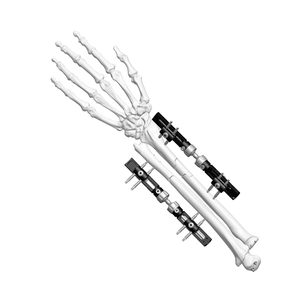 手腕外部固定器（拖拉型）