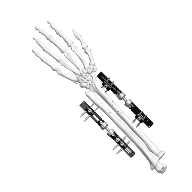 手腕外部固定器（拖拉型）