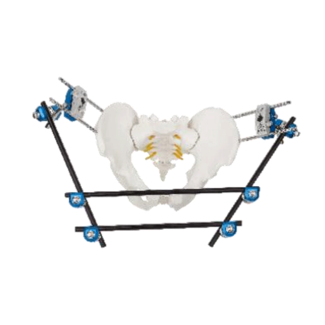 骨盆外部固定器